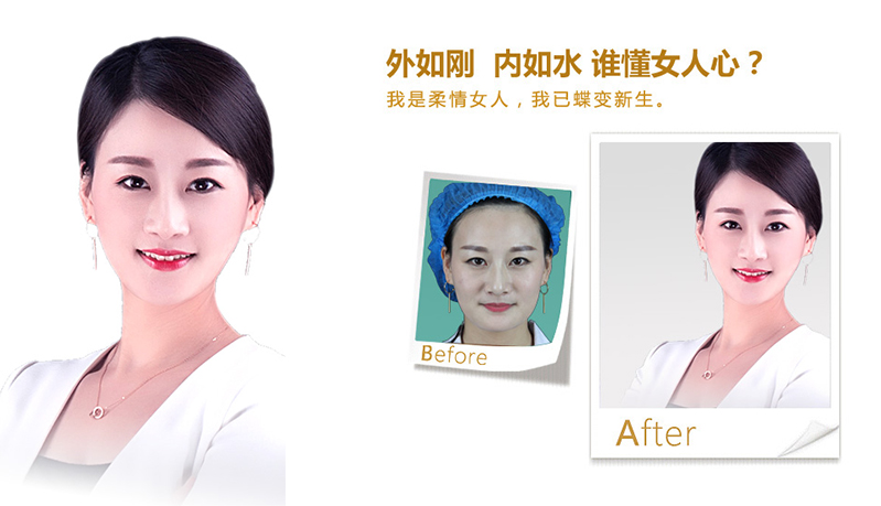 邯郸V脸、线雕隆鼻